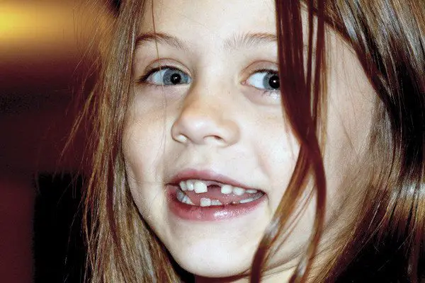 Can You Fly After A Tooth Extraction? Can You Fly After A Tooth Extraction?